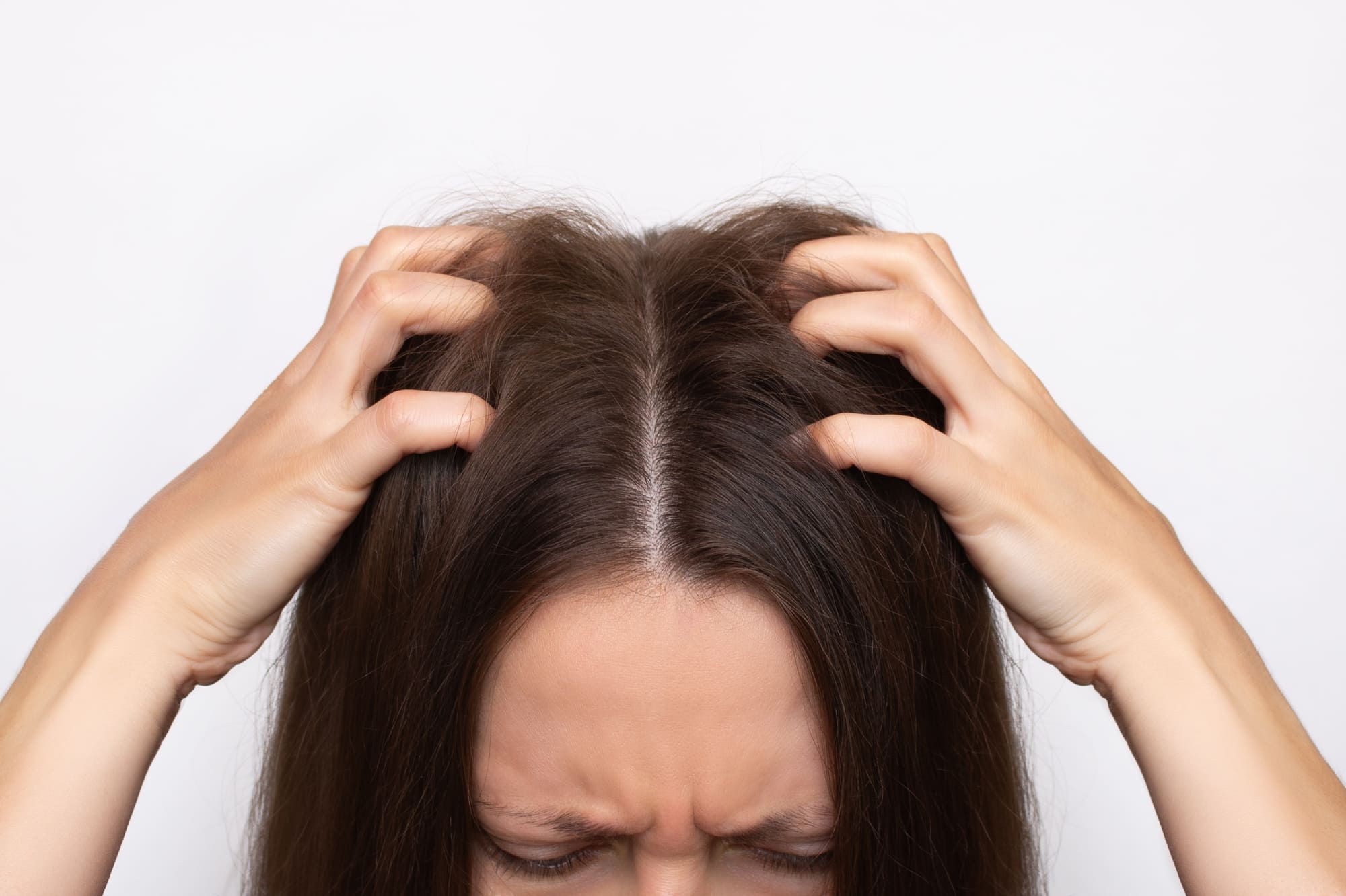 How to treat an irritated scalp